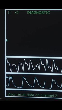 秘密の億万長者の子供と離婚するな episode 41