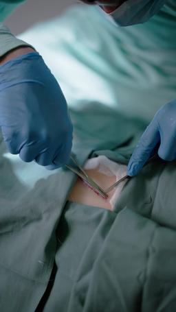 Du hast einen genialen Chirurgen gefeuert episode 35