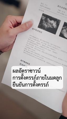 (พากย์) รักสุดใจยัยตัวแสบ episode 87