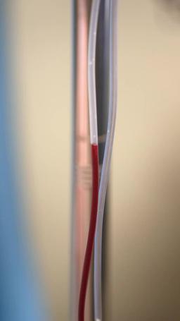 อุ่นไอรักไม่อาจหวนคืน episode 31