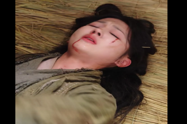 Mi Amiga Porque Tienes Ojeras